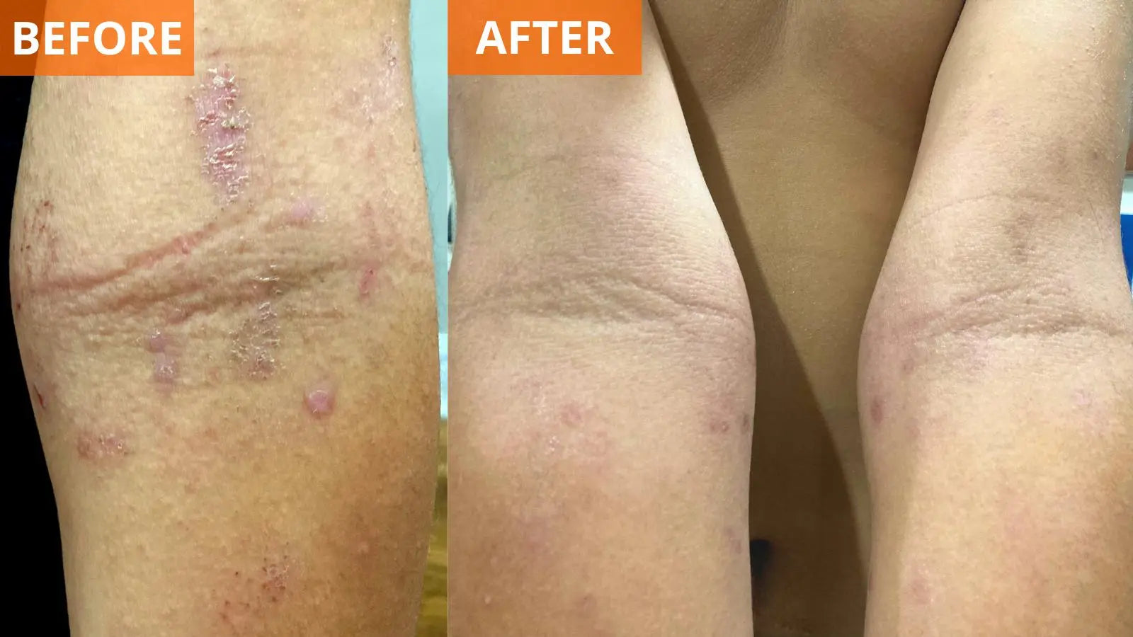 Moisturizing Skin Cream