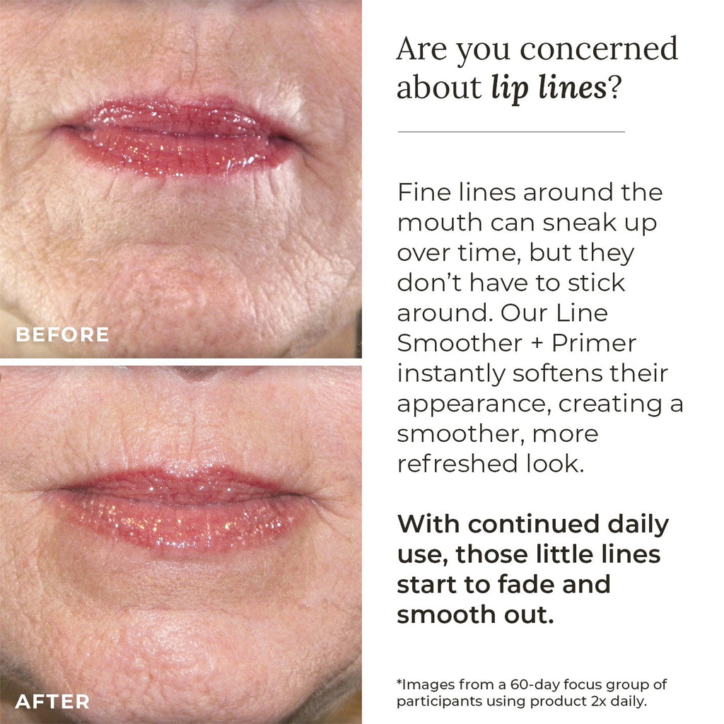 Line Smoother + Primer with Neodermyl®
